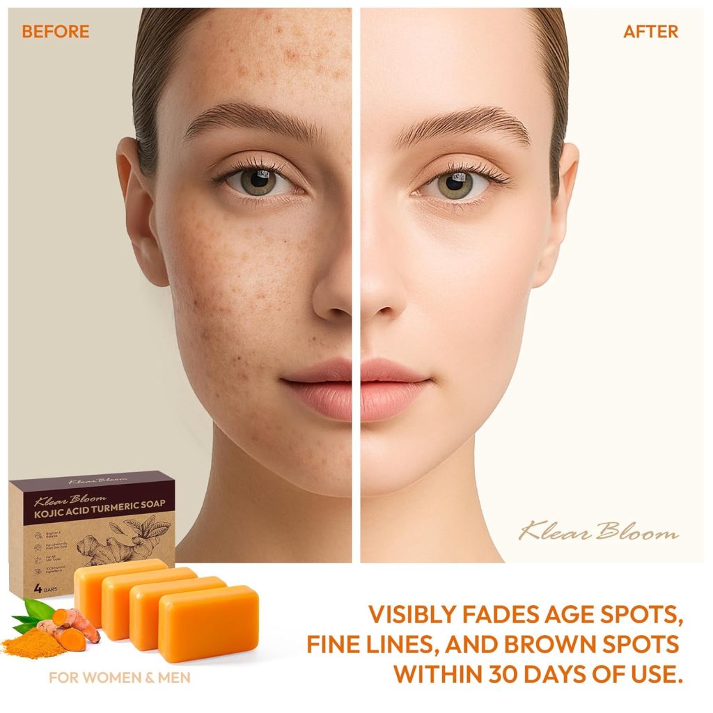 Turmeric Soap for Brightening: Kojic Acid Soap Bars with Collagen, Vitamin E, Retinol, Hyaluronic Acid, and Shea Butter, Paraben & Sulfate-Free, 105g x4 Bars