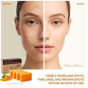 Turmeric Soap for Brightening: Kojic Acid Soap Bars with Collagen, Vitamin E, Retinol, Hyaluronic Acid, and Shea Butter, Paraben & Sulfate-Free, 105g x4 Bars